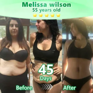 𝐔𝐒𝐀 𝐃𝐨𝐜𝐭𝐨𝐫 𝐑𝐞𝐜𝐨𝐦𝐦𝐞𝐧𝐝𝐞𝐝 🥗|𝐑𝐔𝐃𝑨𝑼𝑶® 𝑩𝒆𝒓𝑏𝘦𝘳𝑖𝗇𝒆 𝟔-𝗶𝙣-𝟏 𝑁𝑎𝑛𝑜 𝘔𝘪𝘤𝘳𝘰𝘯𝘦𝘦𝘥𝘭𝘦 𝖯𝚊𝗍𝖼𝗁 |𝘉𝘢𝘤𝘬𝘦𝘥 𝘣𝘺 𝘴𝘤𝘪𝘦𝘯𝘤𝘦 | 𝟨-𝗂𝗇-𝟣 𝖿𝗈𝗋𝗆𝗎𝗅𝖺 | 𝑅𝑒𝑠𝑢𝑙𝑡𝑠 𝑖𝑛 7 𝑑𝑎𝑦𝑠 🏅