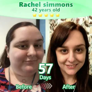 𝐔𝐒𝐀 𝐃𝐨𝐜𝐭𝐨𝐫 𝐑𝐞𝐜𝐨𝐦𝐦𝐞𝐧𝐝𝐞𝐝 🥗|𝐑𝐔𝐃𝑨𝑼𝑶® 𝑩𝒆𝒓𝑏𝘦𝘳𝑖𝗇𝒆 𝟔-𝗶𝙣-𝟏 𝑁𝑎𝑛𝑜 𝘔𝘪𝘤𝘳𝘰𝘯𝘦𝘦𝘥𝘭𝘦 𝖯𝚊𝗍𝖼𝗁 |𝘉𝘢𝘤𝘬𝘦𝘥 𝘣𝘺 𝘴𝘤𝘪𝘦𝘯𝘤𝘦 | 𝟨-𝗂𝗇-𝟣 𝖿𝗈𝗋𝗆𝗎𝗅𝖺 | 𝑅𝑒𝑠𝑢𝑙𝑡𝑠 𝑖𝑛 7 𝑑𝑎𝑦𝑠 🏅